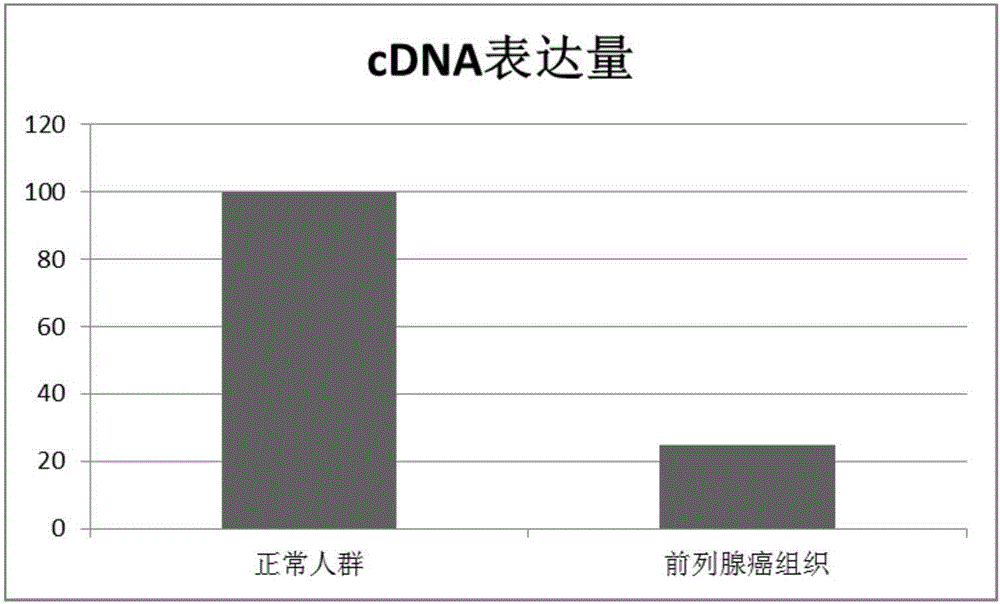 LOC100128675 serving as molecular marker for detecting prostate cancer and application of molecular marker to diagnostic kit