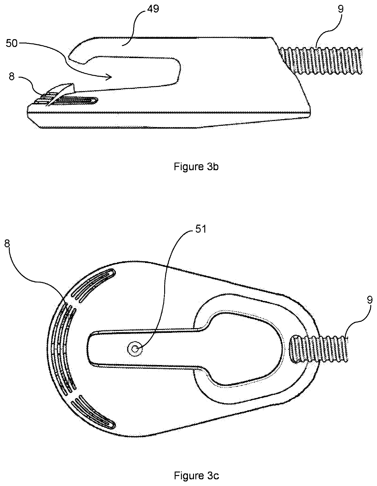 Aesthetic method of biological structure treatment by magnetic field