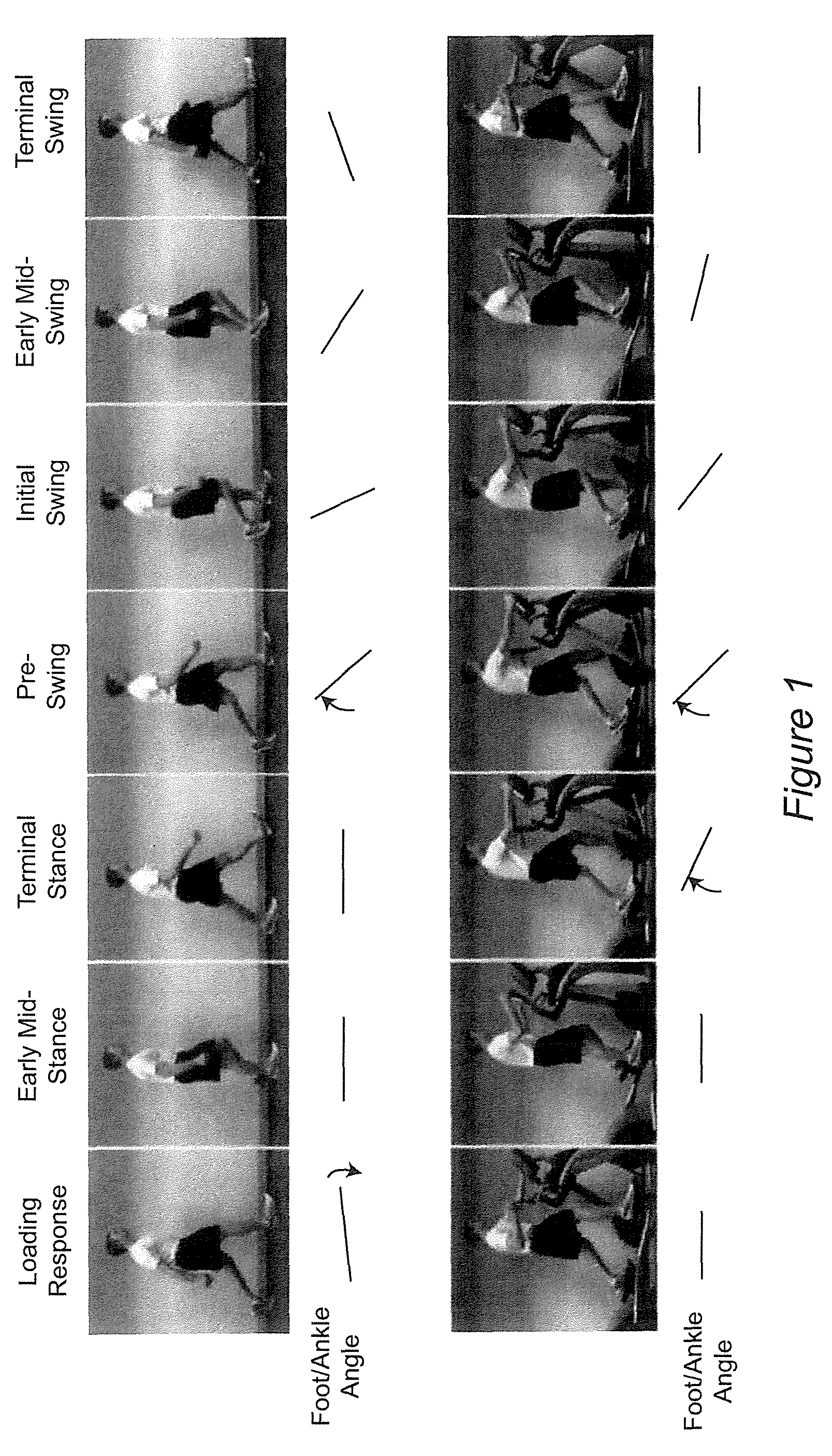 Spasticity reducing closed-loop force-feedback control for post-stroke gait training