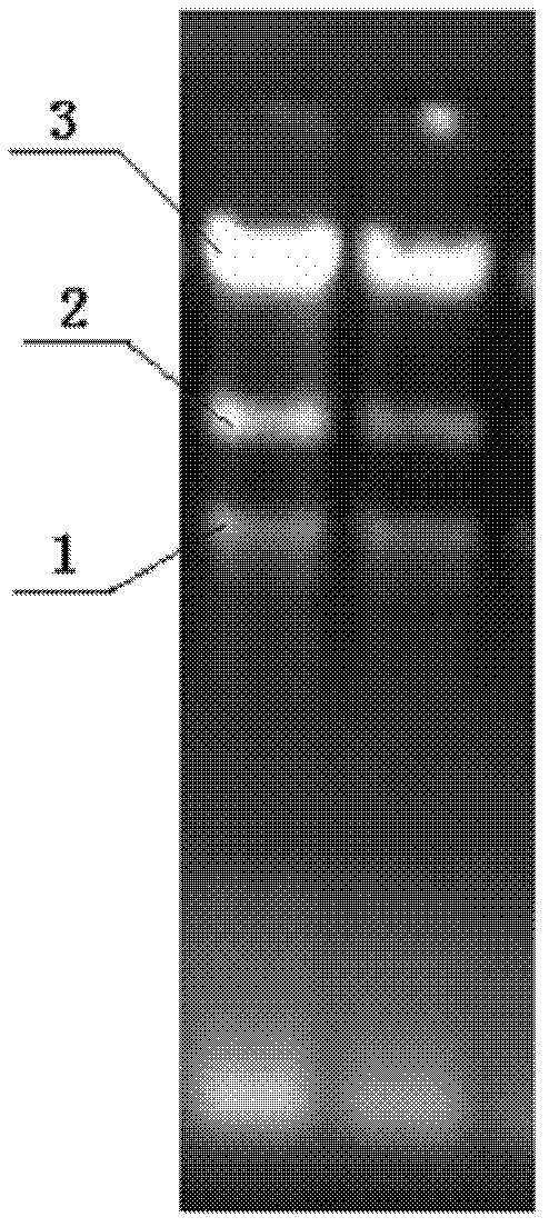 Method for extracting total ribonucleic acid (RNA) from bracts and inflorescences of Anthurium andraeanum