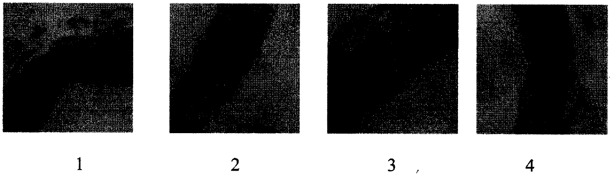 Medicinal composition for treating atherosclerosis and application of medicinal composition