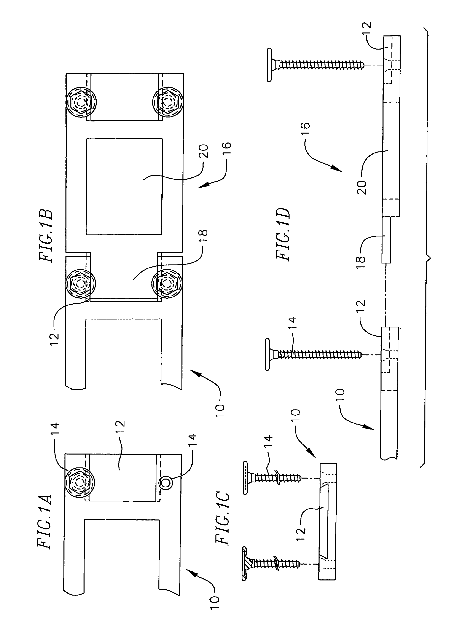 Revisable anterior cervical plating system