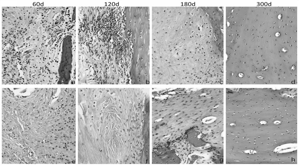 A 3D printed artificial periosteum, artificial bone, artificial bone and preparation method thereof