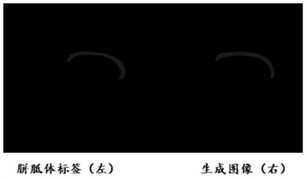 A method for constructing corpus callosum segmentation prediction images for corpus callosum state assessment