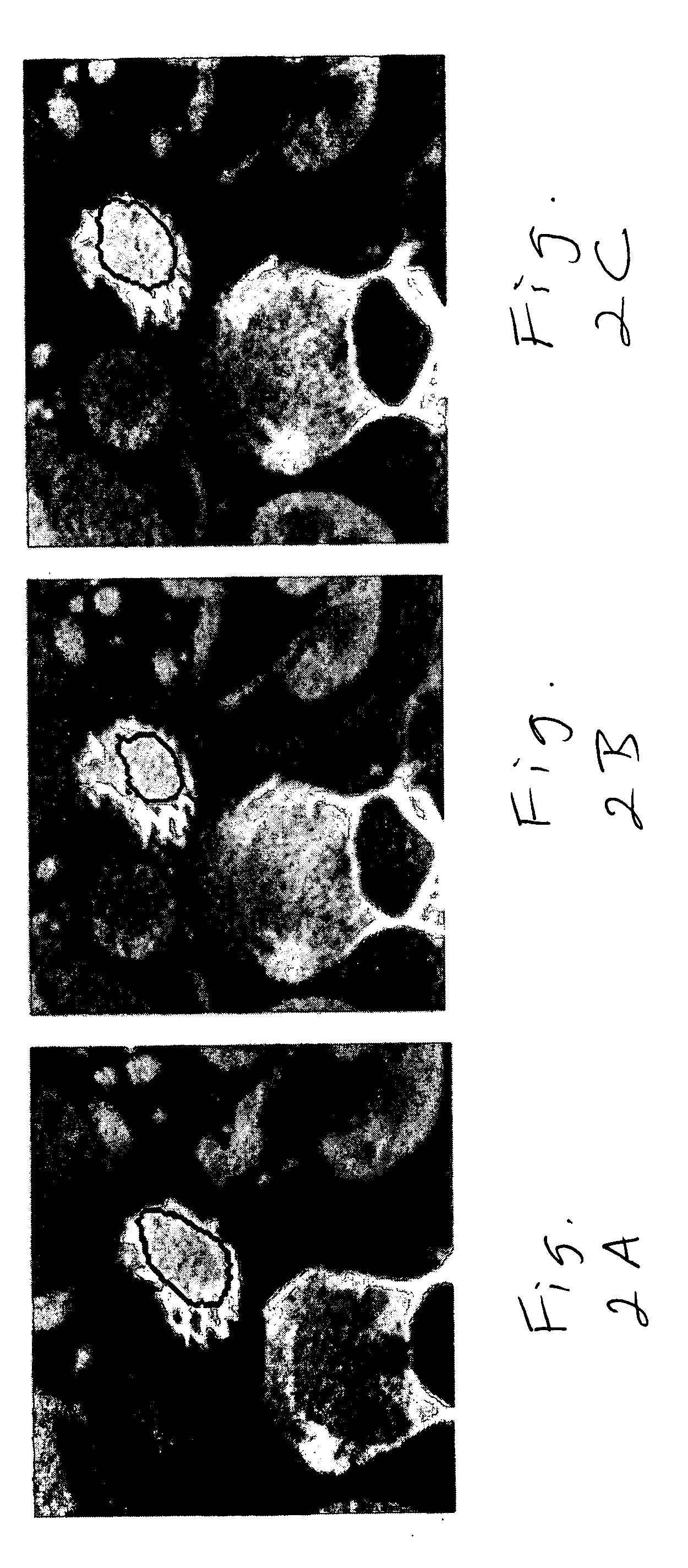 Semi-automated measurement of anatomical structures using statistical and morphological priors