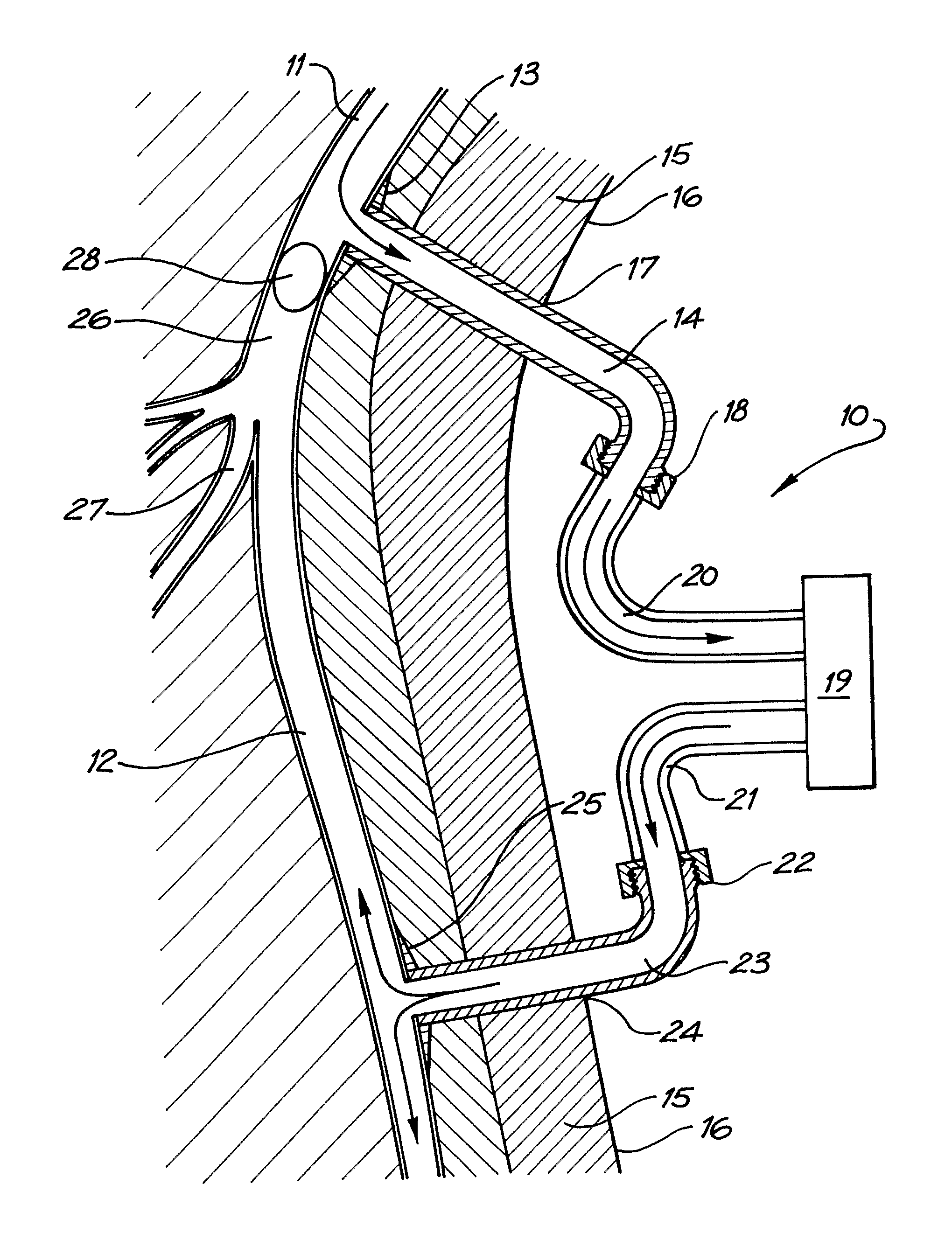 Peripheral access devices and systems