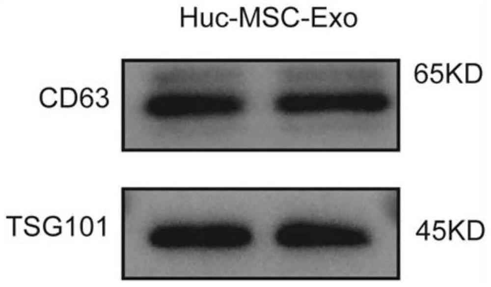 Application of miR-663a or target gene CKDN2A thereof in thin endometrium