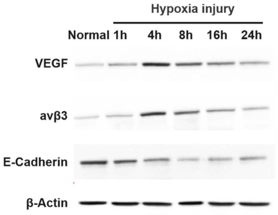 Application of miR-663a or target gene CKDN2A thereof in thin endometrium