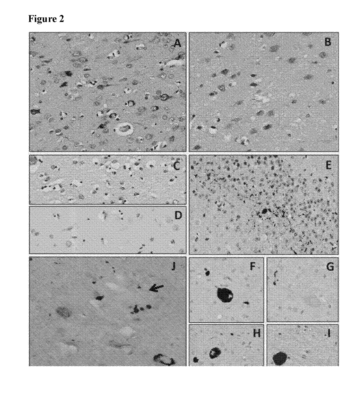 Human anti-tau antibodies