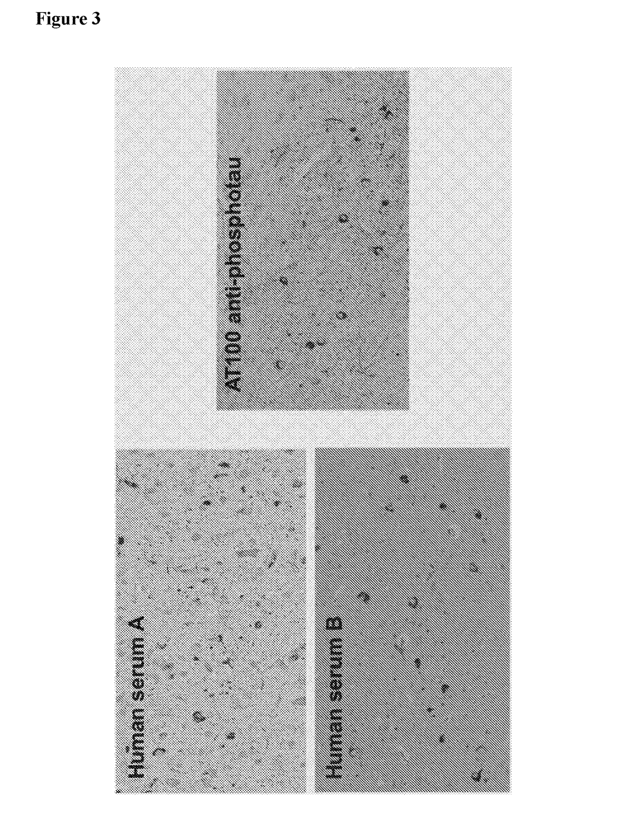 Human anti-tau antibodies