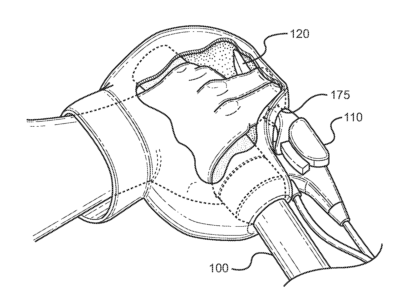 Bicycle Handlebar Cover