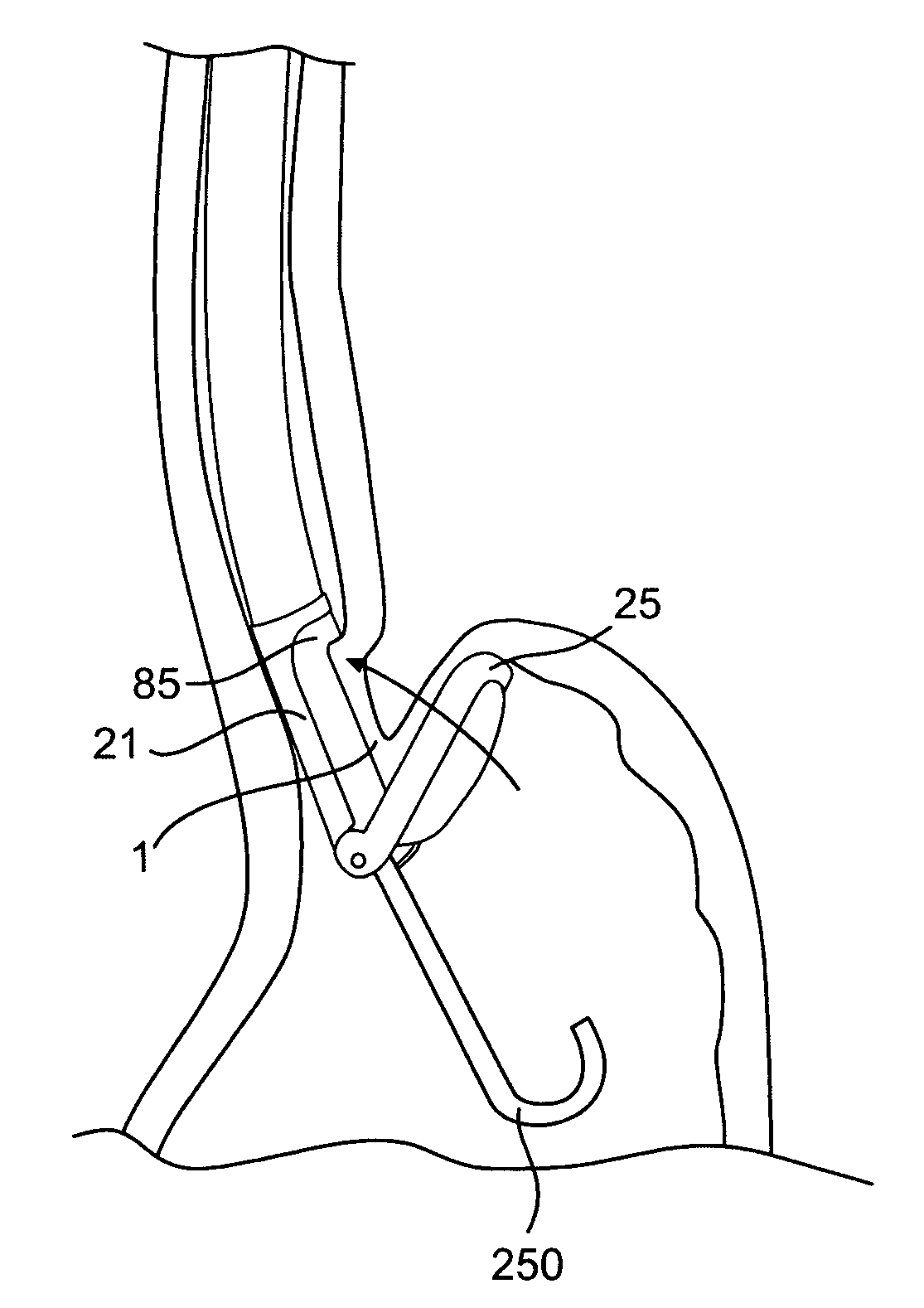 Devices and methods for fastening tissue layers