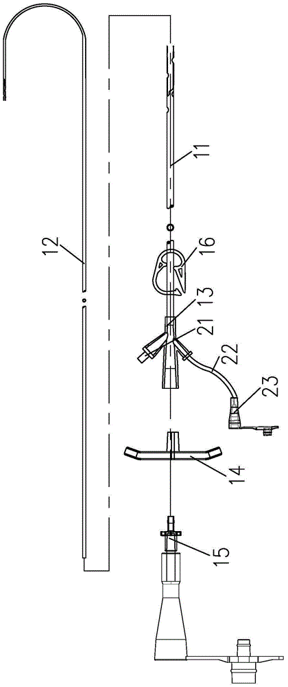 Separable Nasogastric Tube