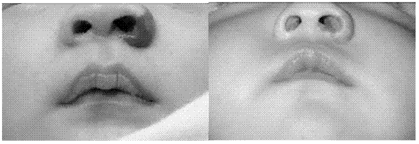 External medicament for treating infant hemangioma and preparation method thereof