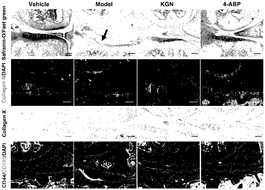 Application of chemical small molecule 4-aminobiphenyl in prevention and treatment of osteoarthritis