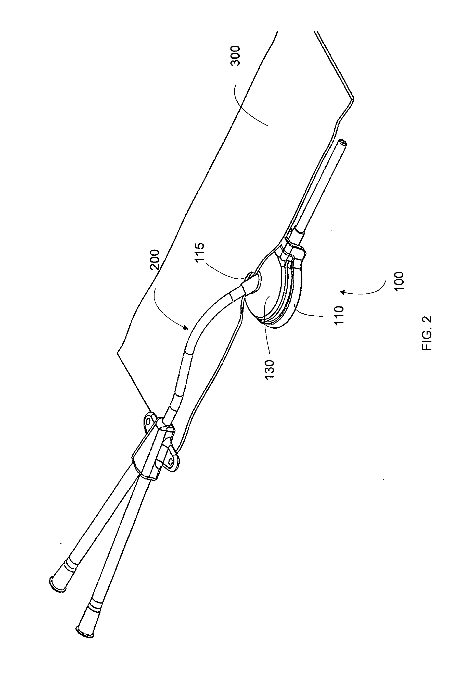 Deformable medical implant