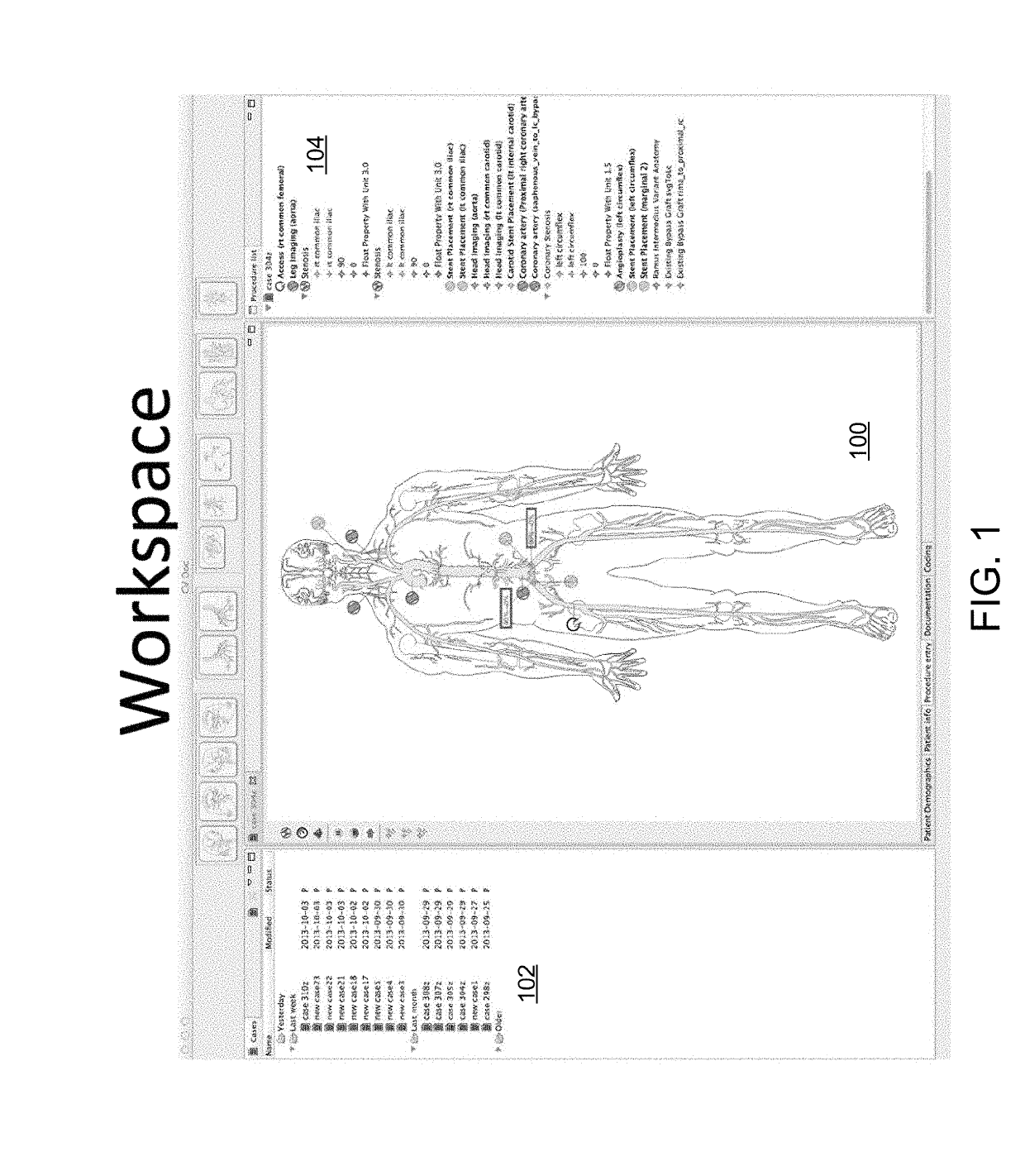 Automated medical procedure coding and documentation system