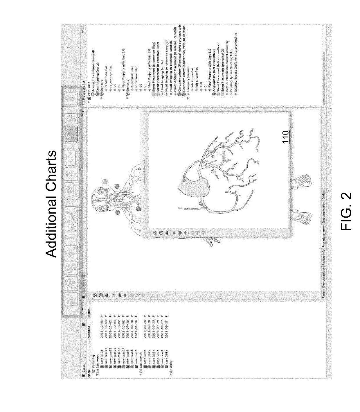 Automated medical procedure coding and documentation system