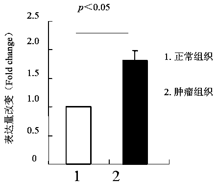 Biomarker long-chain non-coding RNA LINC01728 and kit for predicting prognosis of colon cancer