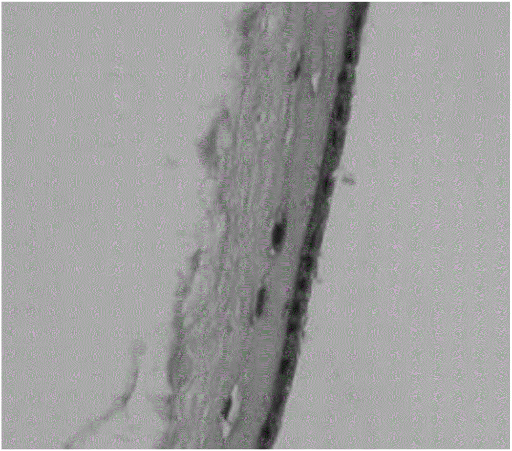 Preparing method and application of acellular amniotic membrane used for repairing skin wound difficult to heal