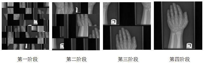 Progressive bone age assessment method based on multi-granularity feature fusion