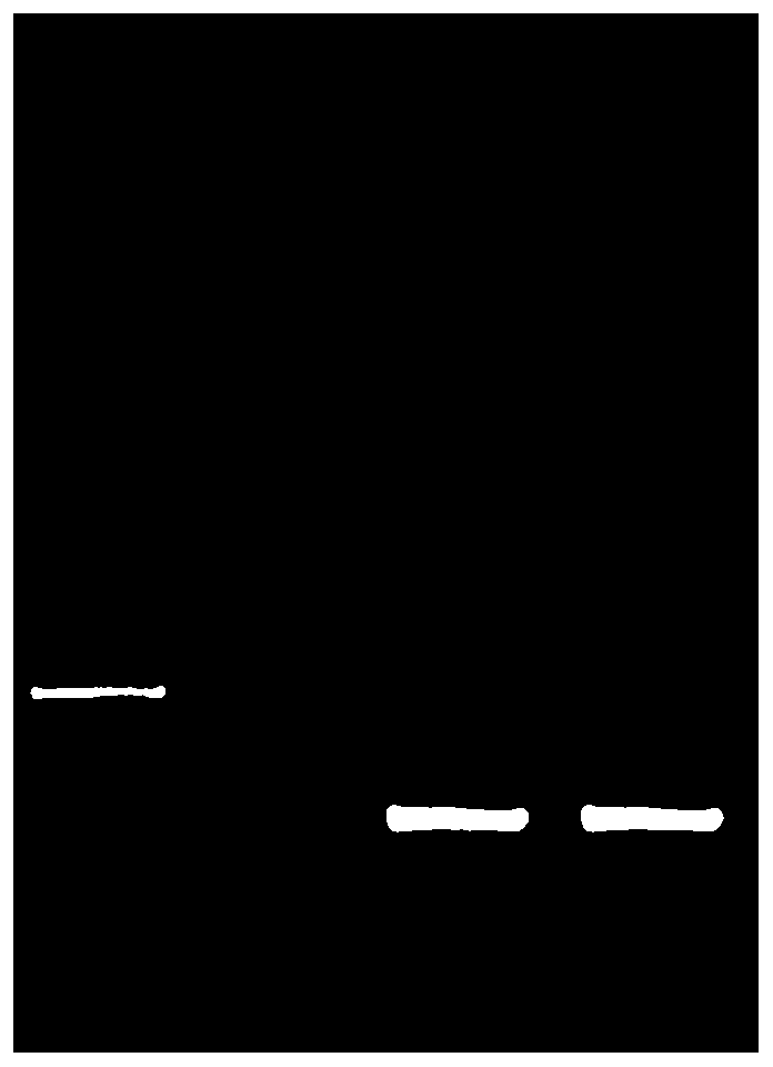 Kit and method for extracting microbial DNA