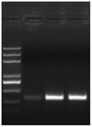 Kit and method for extracting microbial DNA