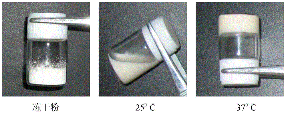 Cyclic ether side group-containing amphiphilic polymer lyophilized powder and composition thereof, and applications of composition