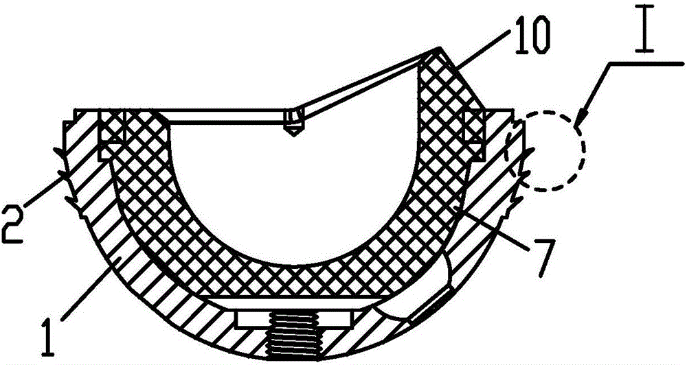 Biological-fixation acetabular prosthesis with adjustable angle