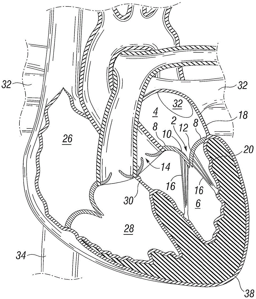 Prosthetic valve for mitral valve replacement