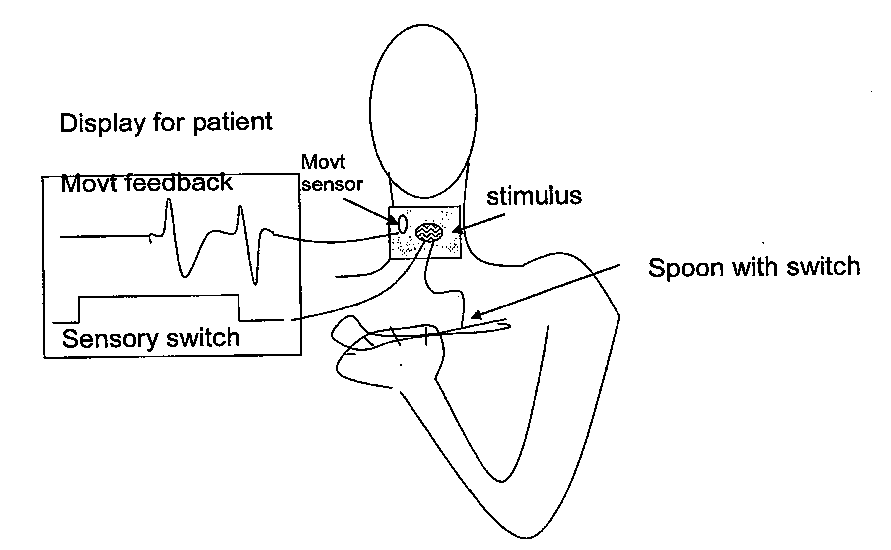 Systems and methods for recovery from motor control via stimulation to a substituted site to an affected area