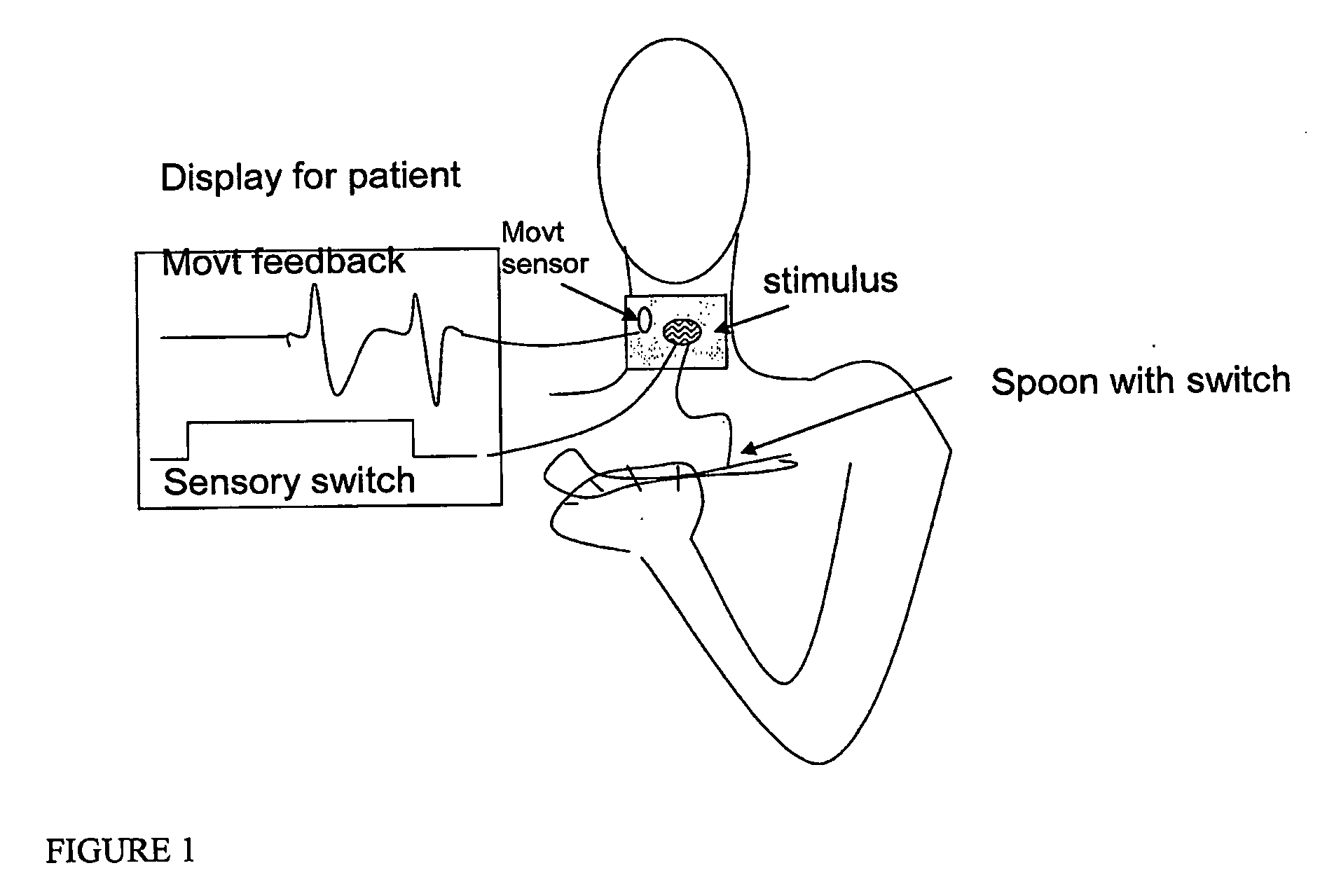 Systems and methods for recovery from motor control via stimulation to a substituted site to an affected area