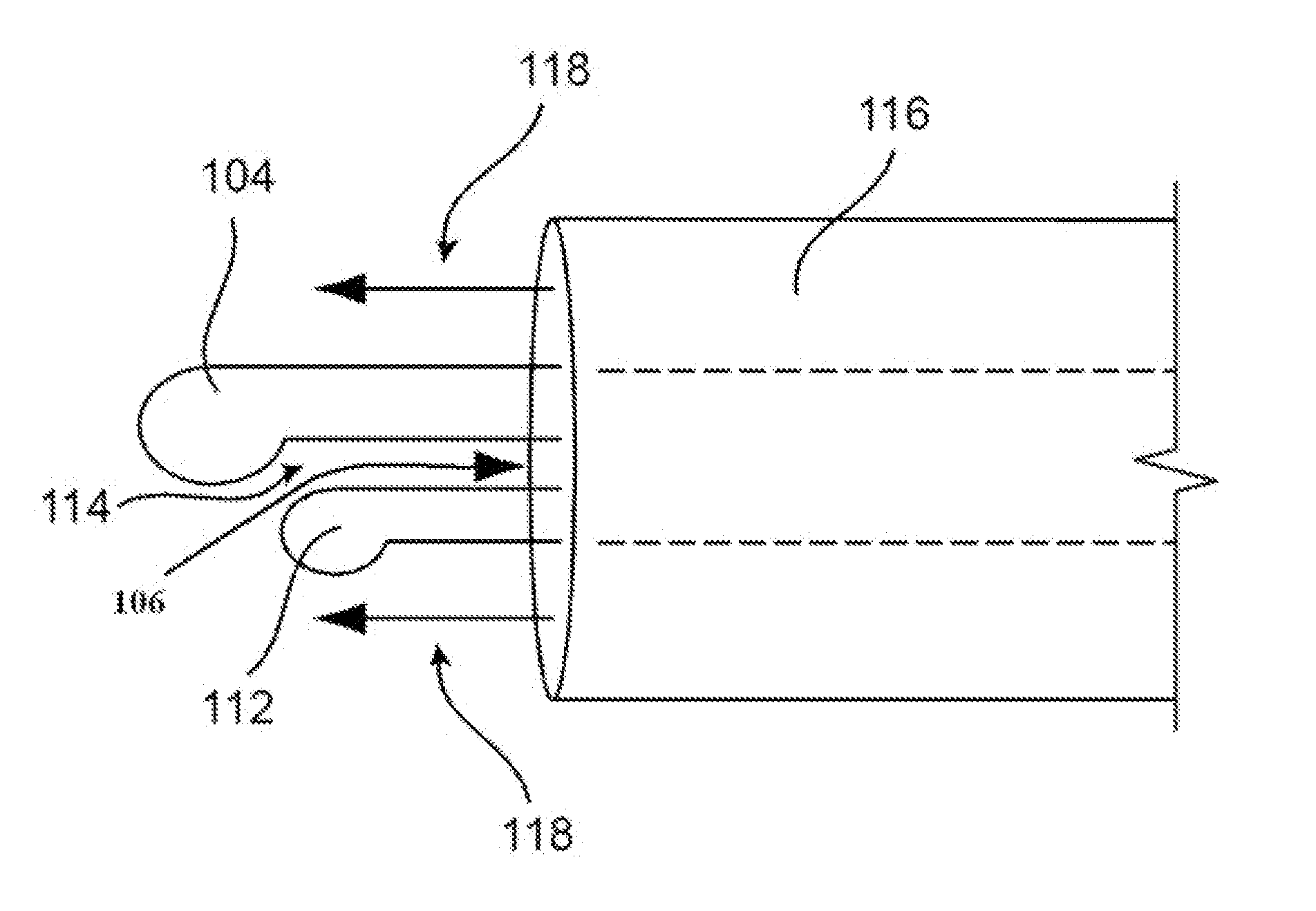 Cataract removal device and integrated tip