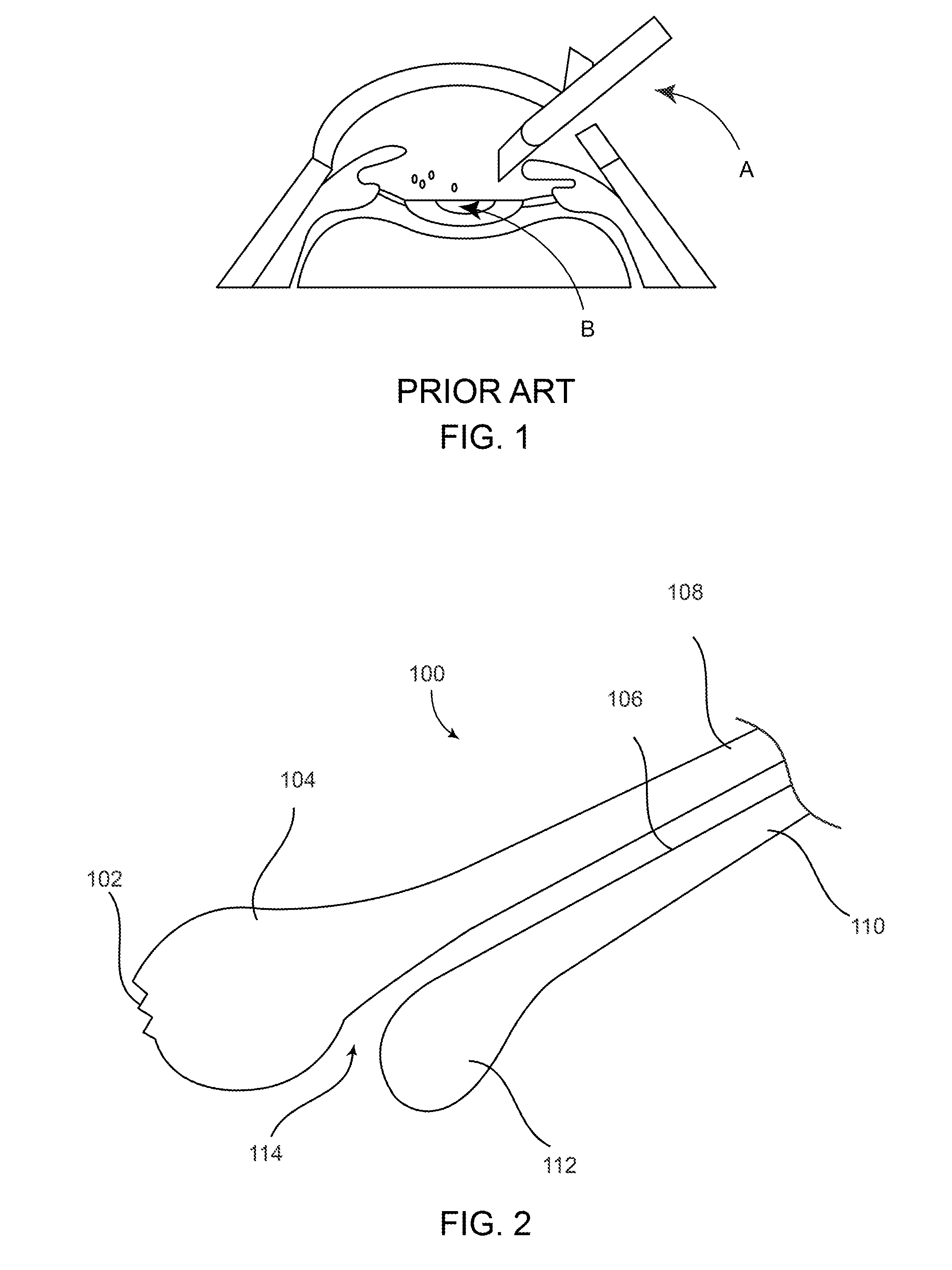 Cataract removal device and integrated tip