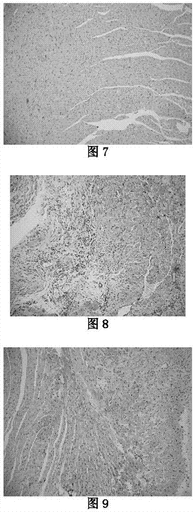 Application of allicin multi-layer enteric-coated tablets as medicine for the treatment of myocardial infarction