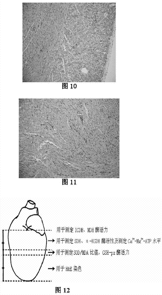 Application of allicin multi-layer enteric-coated tablets as medicine for the treatment of myocardial infarction