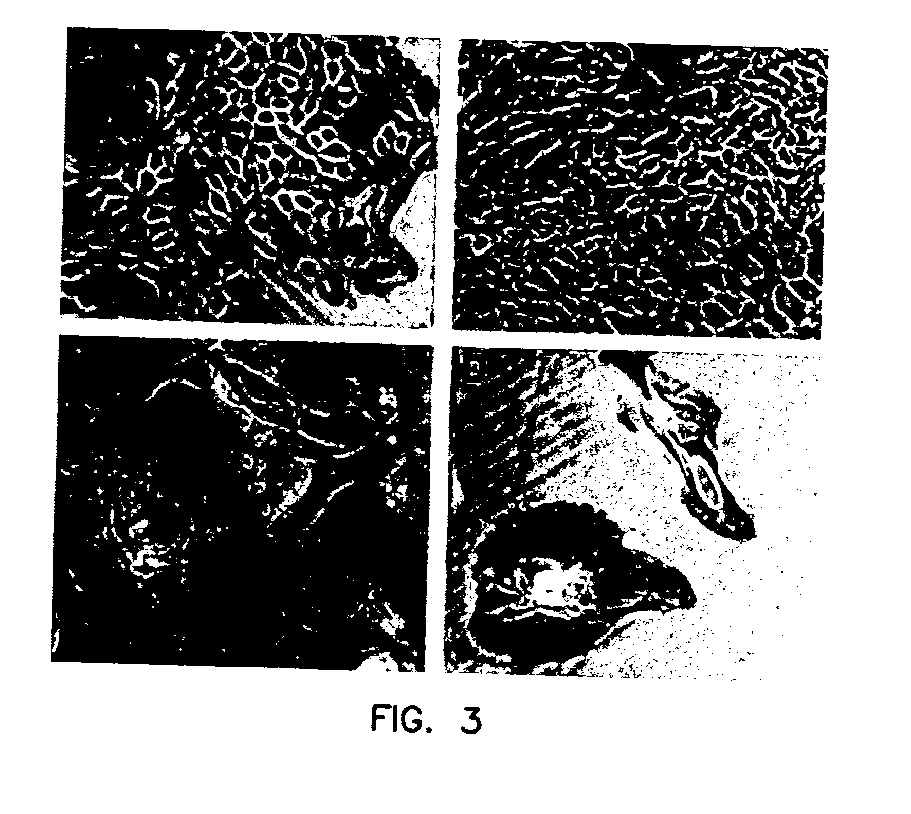 Methods to prepare and use epidermal stem cells