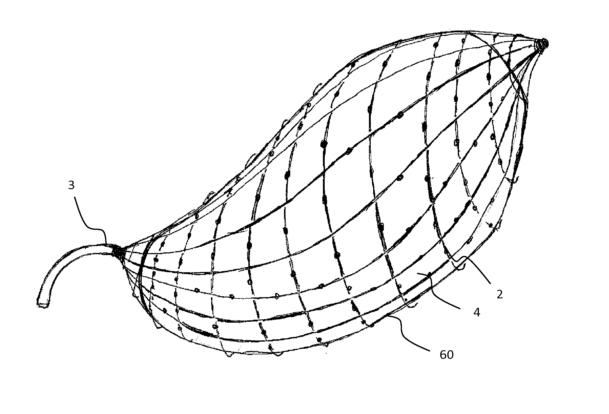 Sensing system, device and methods for gastroparesis monitoring