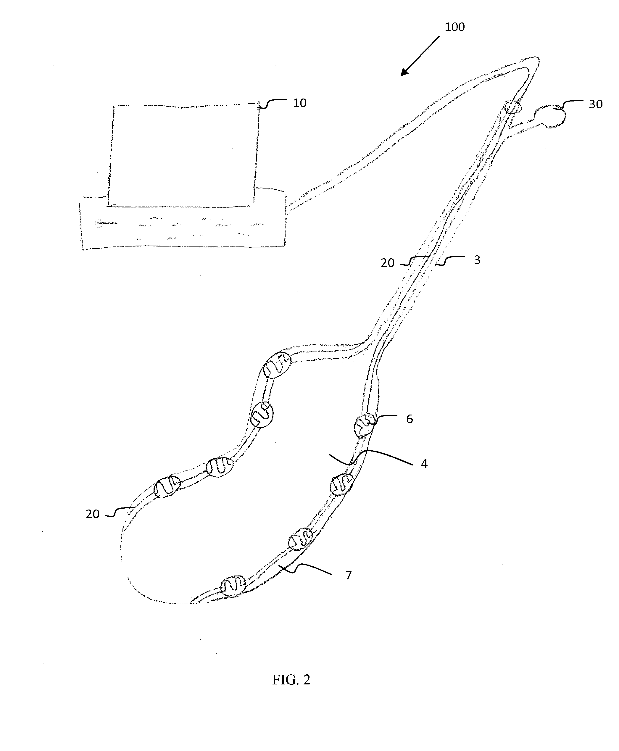 Sensing system, device and methods for gastroparesis monitoring