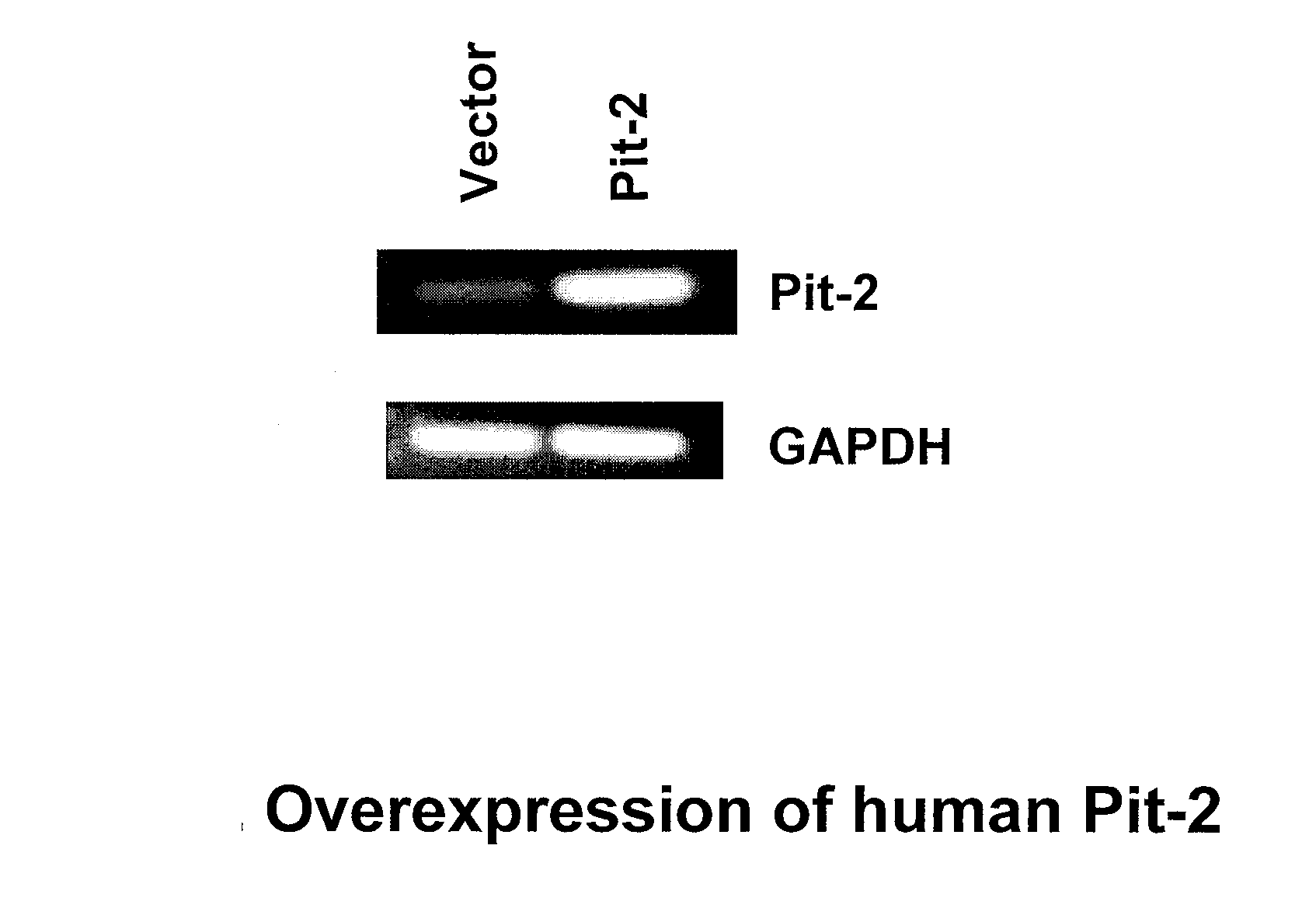 Pit-1 and vascular calcification