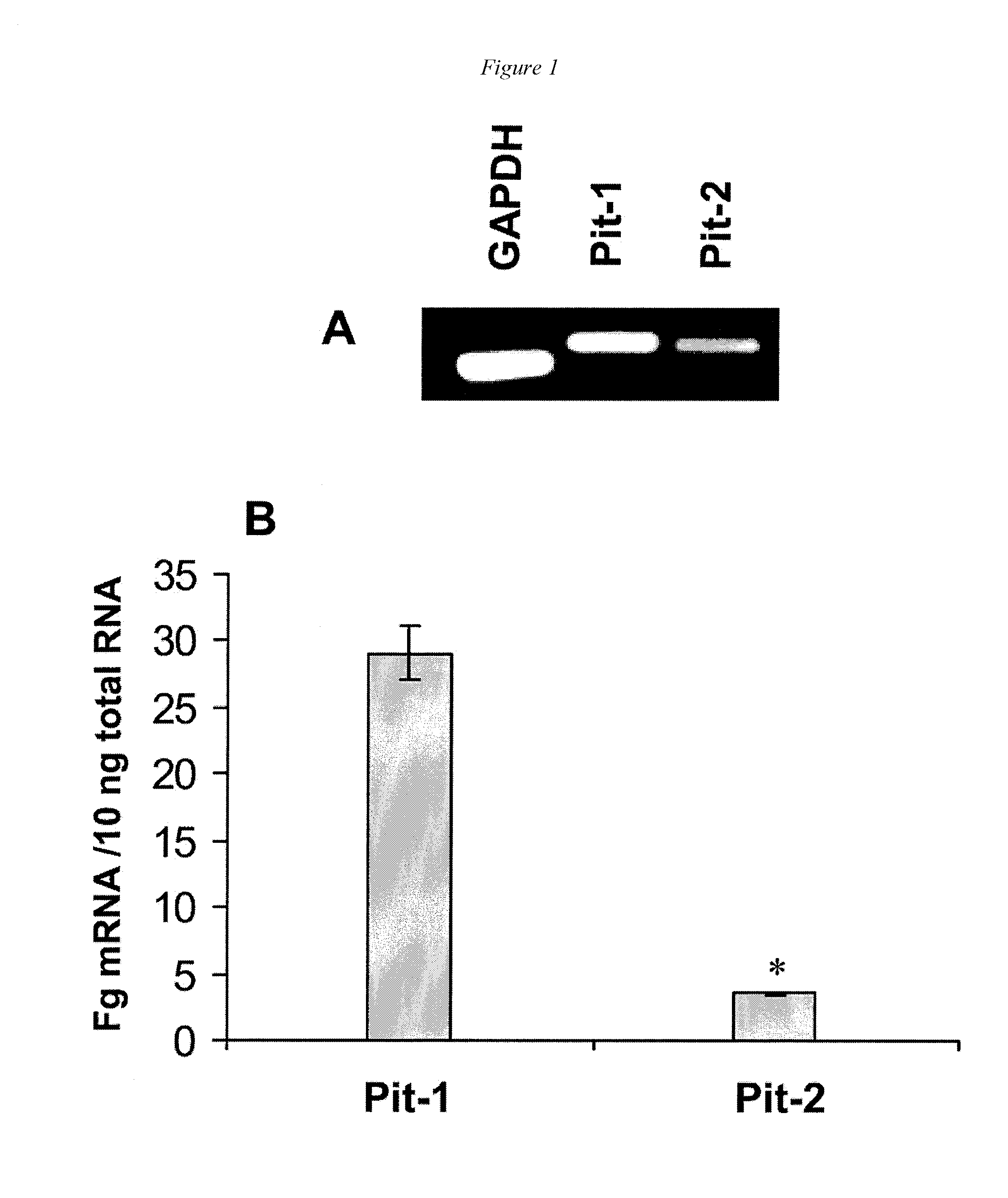 Pit-1 and vascular calcification