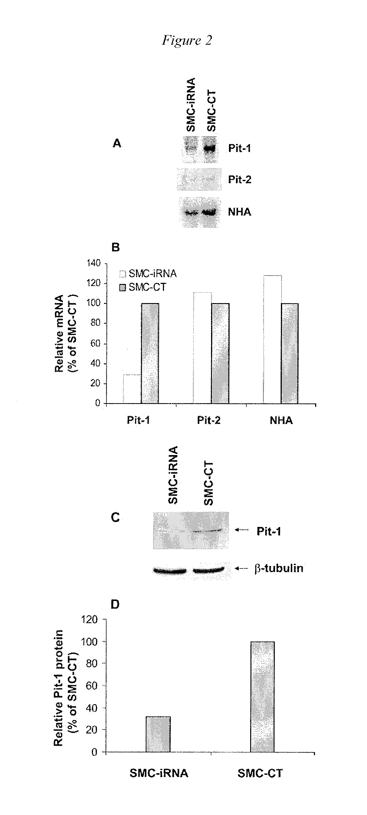 Pit-1 and vascular calcification