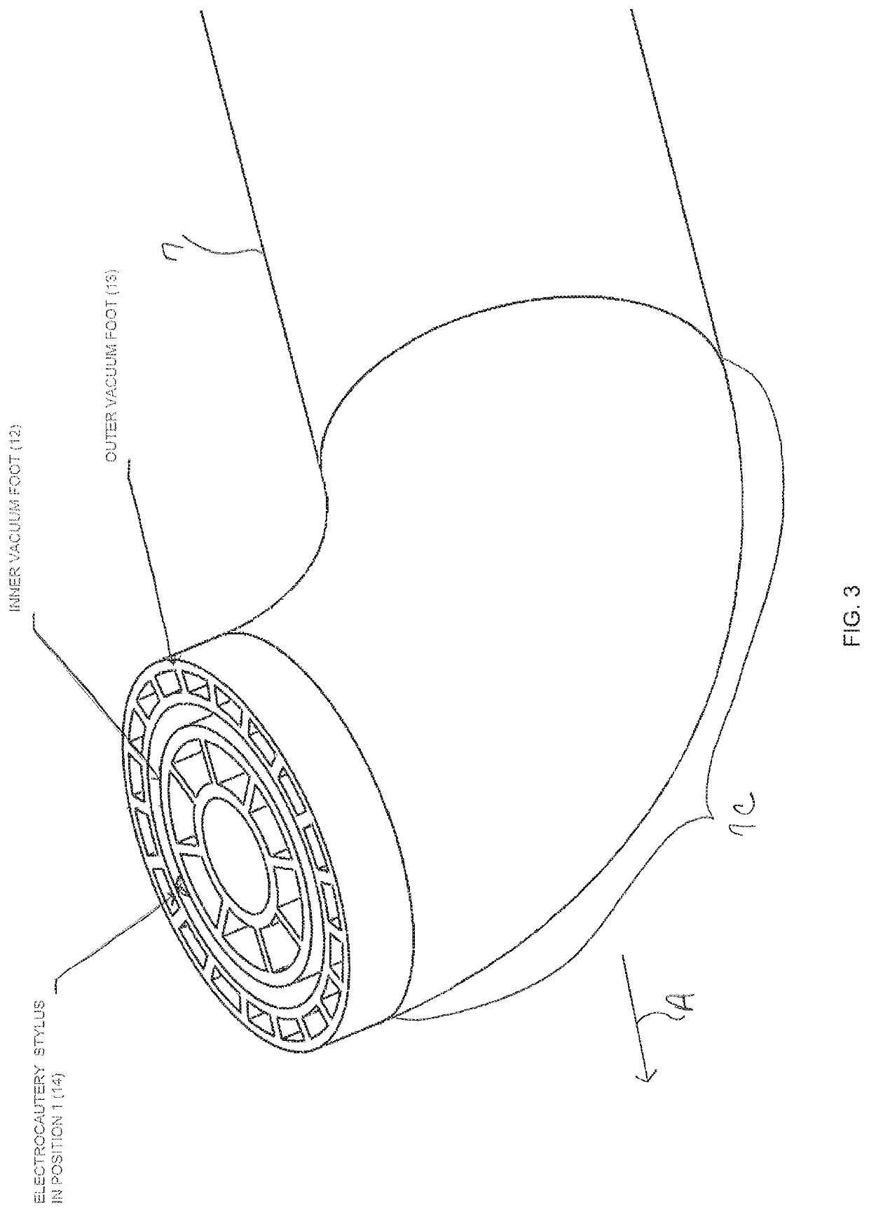 Dual vacuum device for medical fixture placement including for thoracoscopic left ventricular lead placement