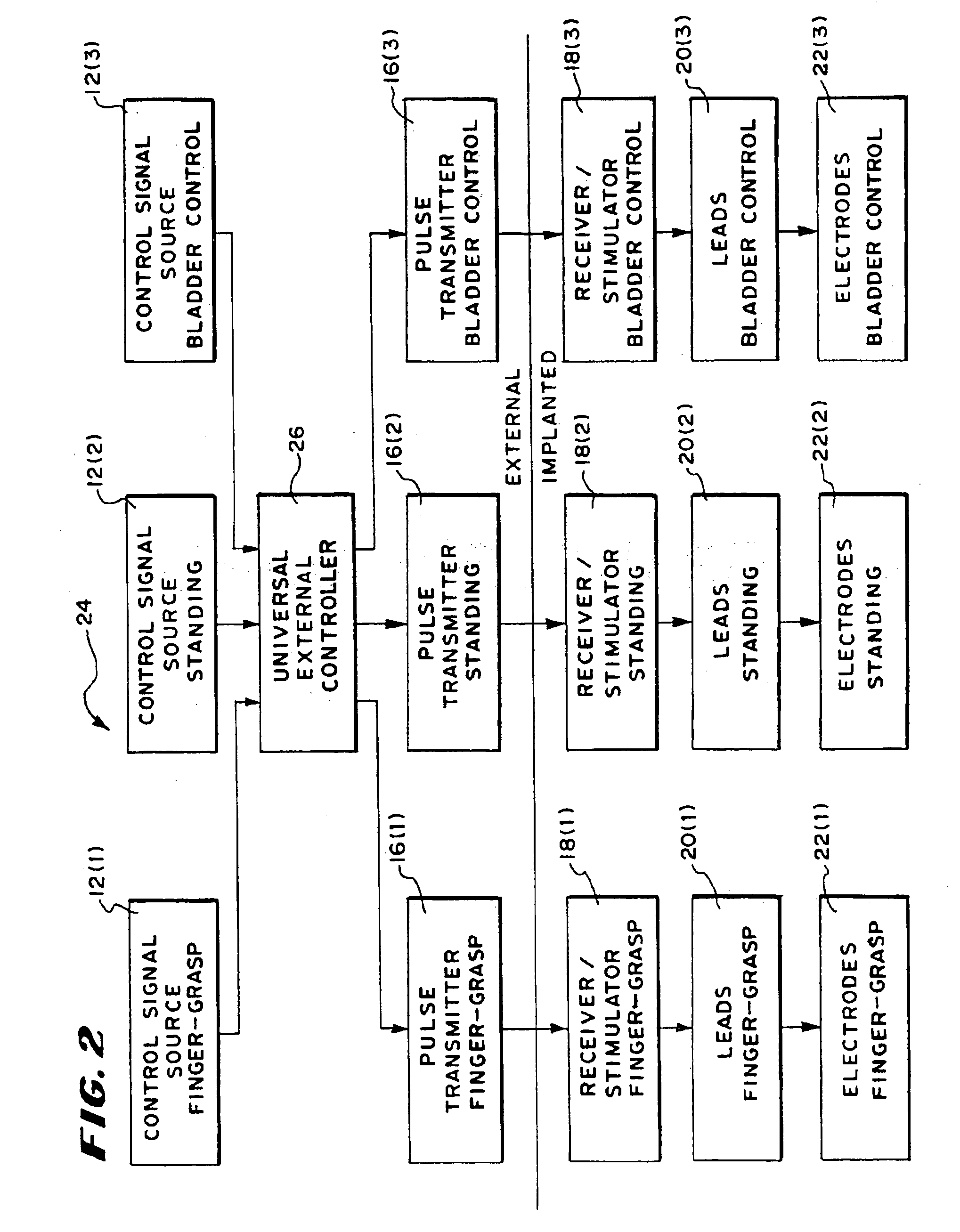 Systems and methods for performing prosthetic or therapeutic neuromuscular stimulation using a universal external controller accommodating different control inputs and/or different control outputs