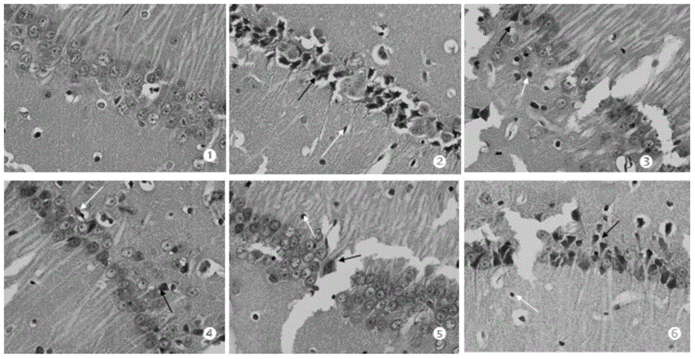 Medicinal composition for treating diabetic encephalopathy as well as preparation method and application thereof