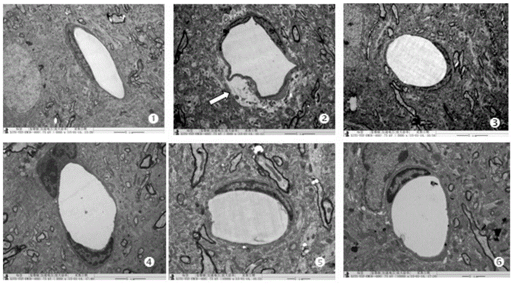 Medicinal composition for treating diabetic encephalopathy as well as preparation method and application thereof