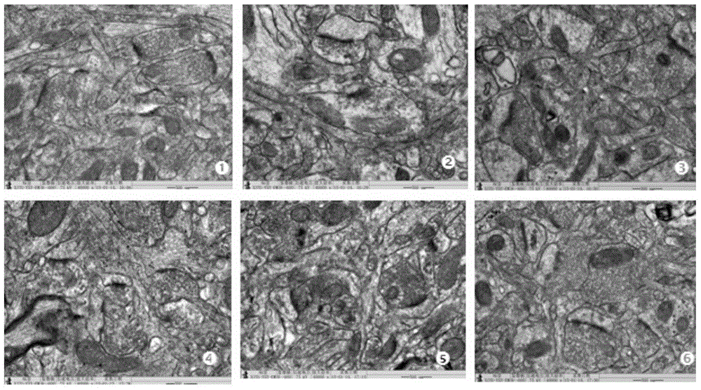 Medicinal composition for treating diabetic encephalopathy as well as preparation method and application thereof