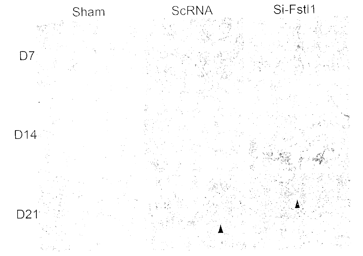 Anti-pulmonary fibrosis application of small interfering RNA of Fstl 1