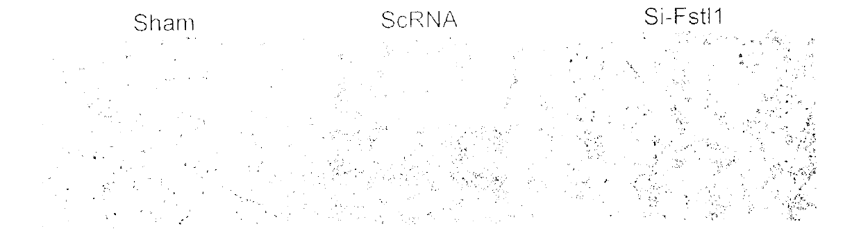 Anti-pulmonary fibrosis application of small interfering RNA of Fstl 1