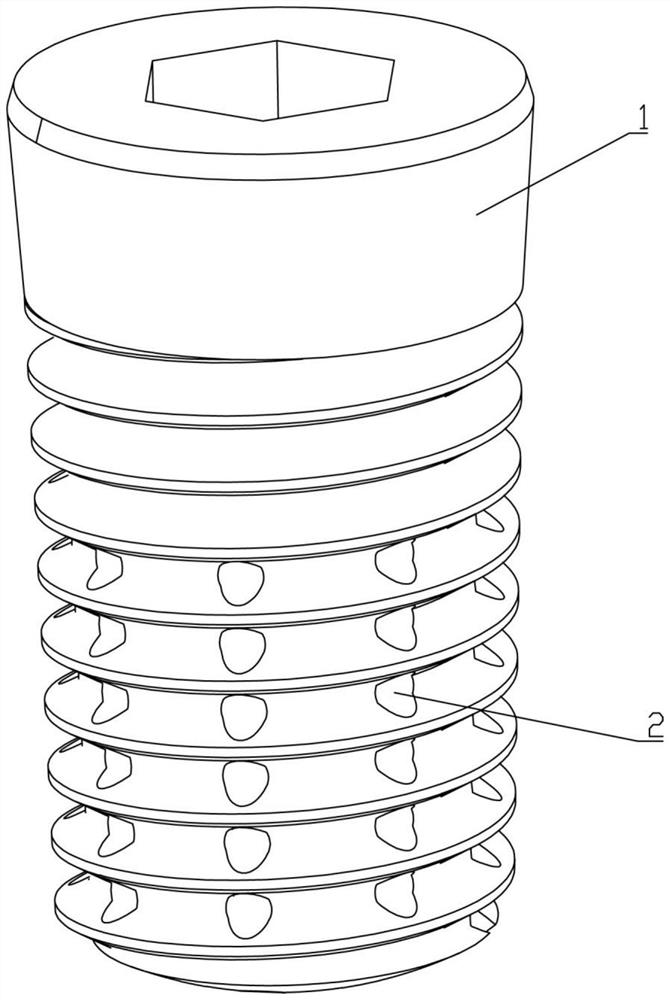 Composite dental implant and preparation method thereof